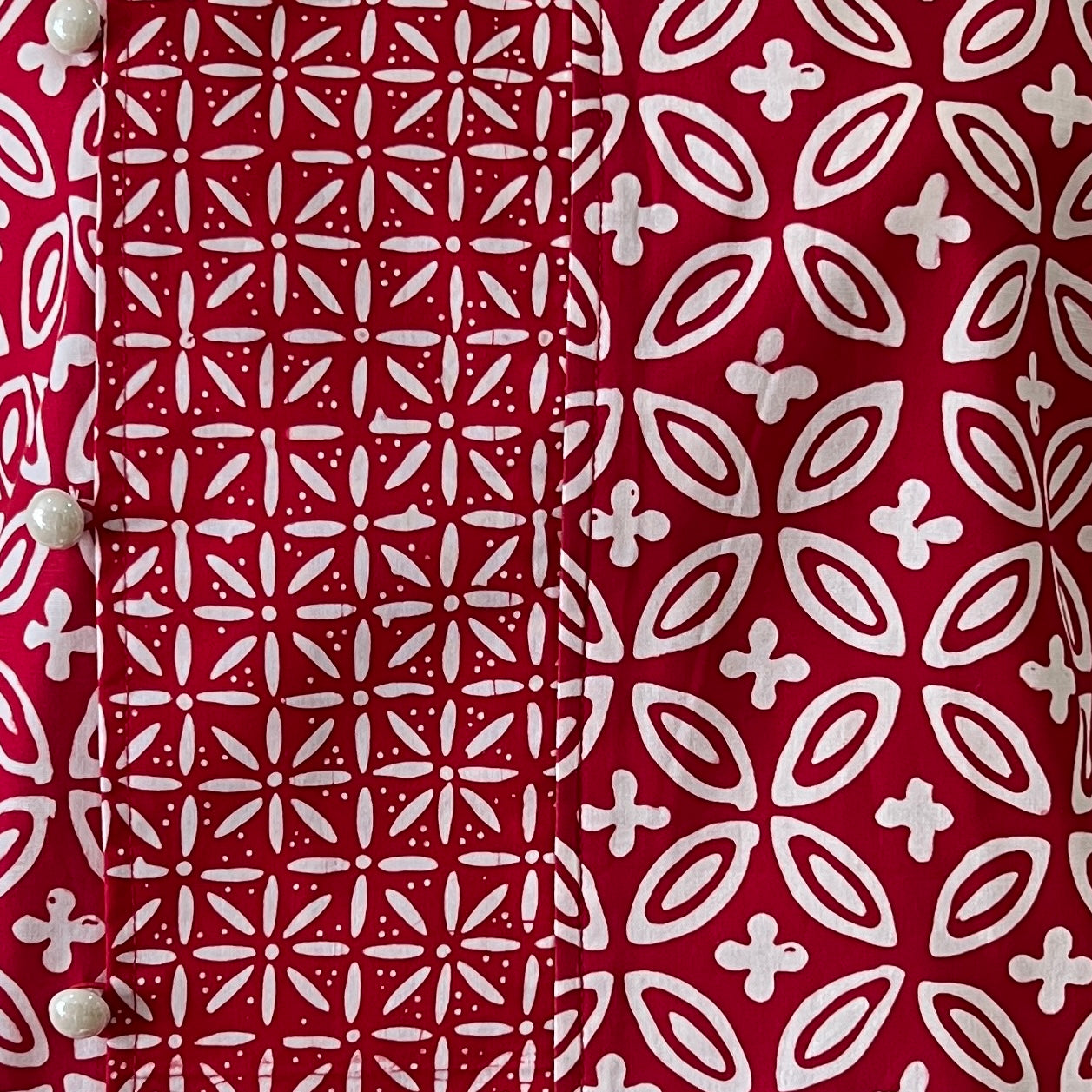 Tropical Side Button Top - S